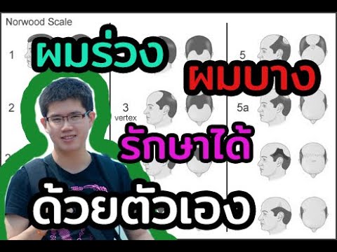 วิธีรักษา ผมร่วง ผมบาง ศรีษะล้าน l 10นาทีกับหมอต่อ