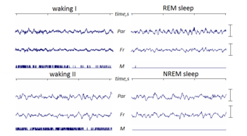 Rapid Eye Movement Sleep - Wikipedia