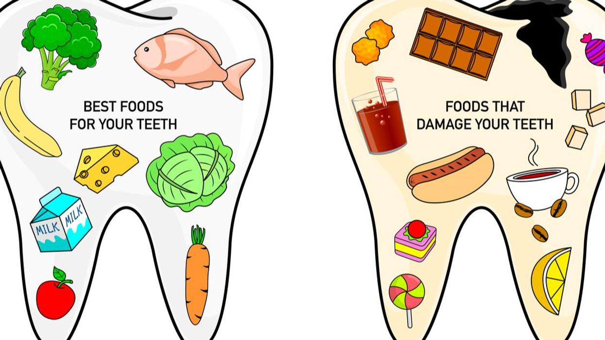 Snacking And Your Teeth - Consumer Health News | Healthday