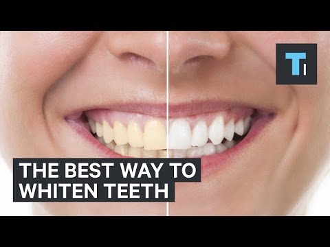 The best way to whiten teeth