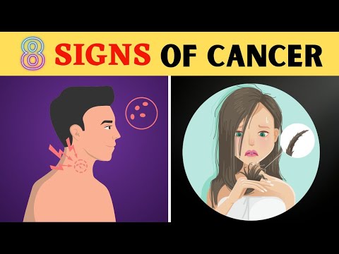 8 Signs You Have Cancer and Don't Know It